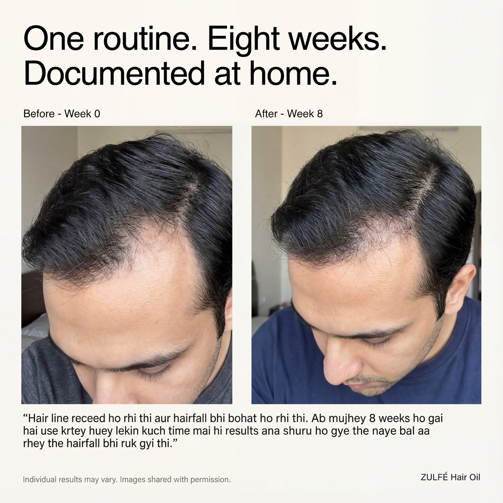 Zulfé ® Herbs‑Infused Hair Oil